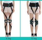 O/X Legs Correction Belt, Adjustable Legs Posture Corrector Band,Unisex O/X Legs Type Legs Bandage for Men Women（JD003L） - Image 5