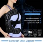 Approved Adjustable Scoliosis Brace Professional Back Support with Spinal Curvature for Scoliosis Patients（JD103B） - Image 5