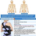Approved Adjustable Scoliosis Brace Professional Back Support with Spinal Curvature for Scoliosis Patients（JD103B） - Image 2