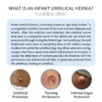Baby hernia belt, protects the navel, provides all-around protection for the baby's navel, specially designed for infants.（JD019HB） - Image 9